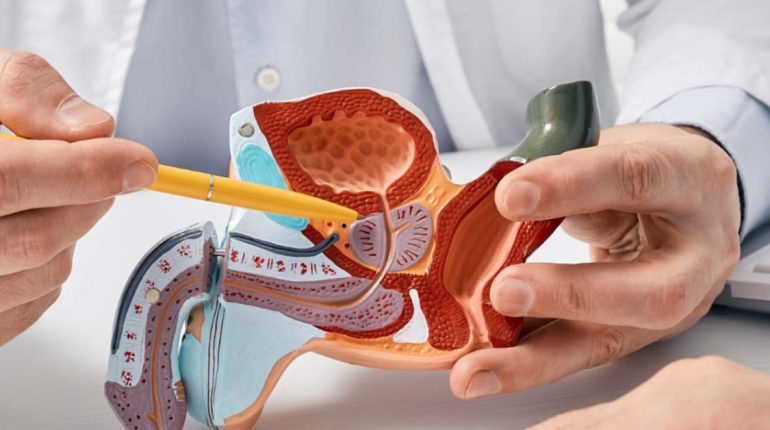 Cáncer de Próstata